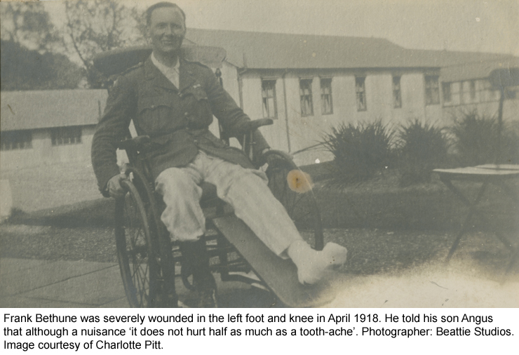 Frank Bethune in April 1918, wounded in the left foot and knee.